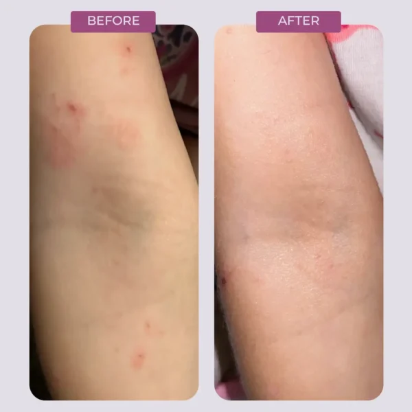 Make Dew Vegan Salve before and after